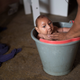 Image for article titled Zika babies reveal our society’s deep, dangerous prejudice against disabilities